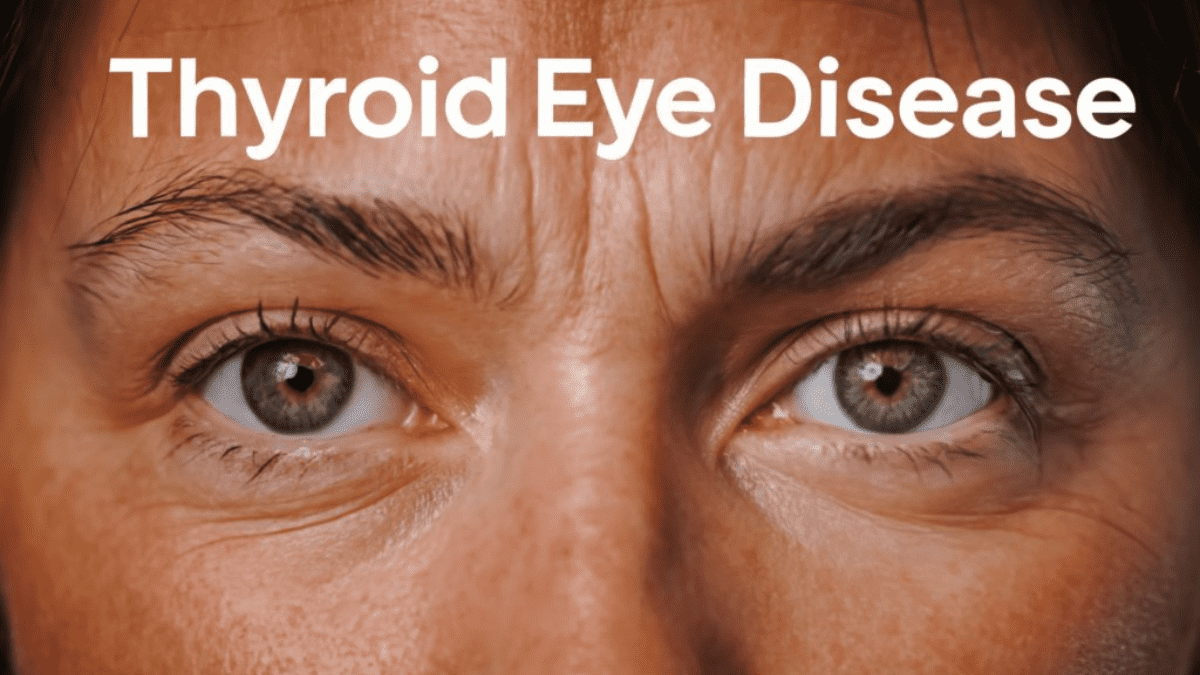 Thyroid Eye Disease Symptoms